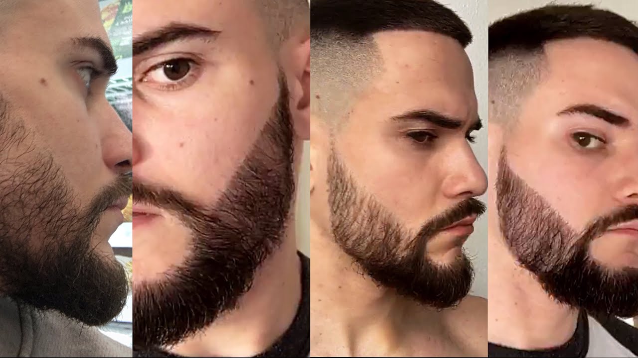 greffe barbe Tunisie