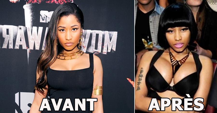 nicki Minaj avant et après